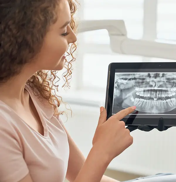 dental xrays digital radiographs