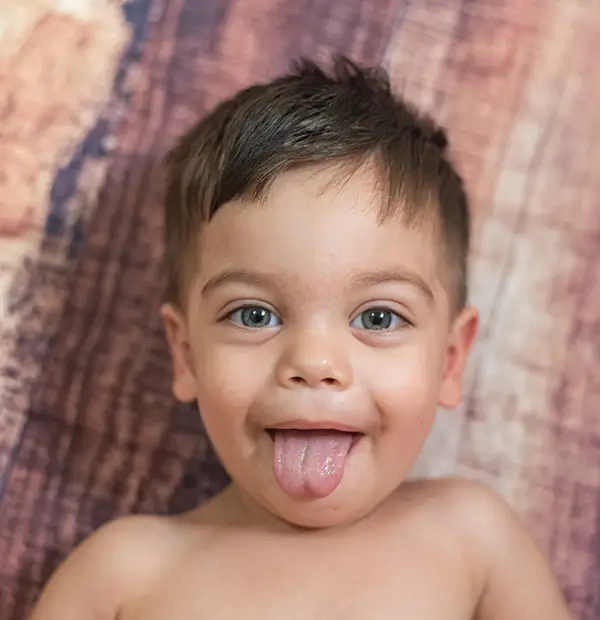 Baby tongue and lip tie release result