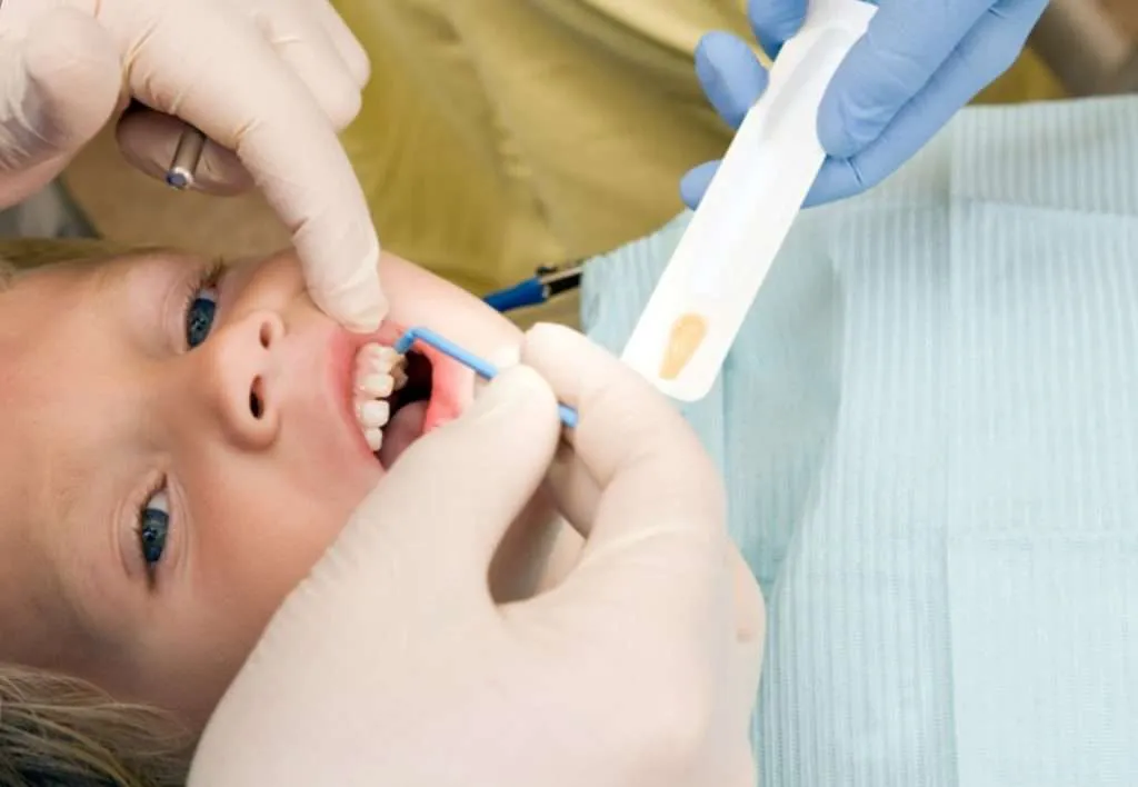 Safe and effective fluoride treatment for kids at Lansdowne Pediatric Dentistry