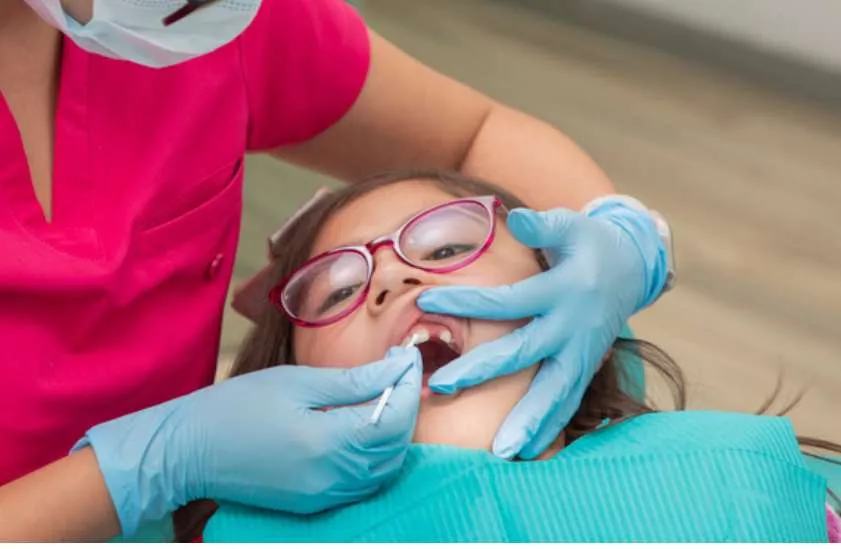 Fluoride treatment for kids to prevent cavities and strengthen enamel