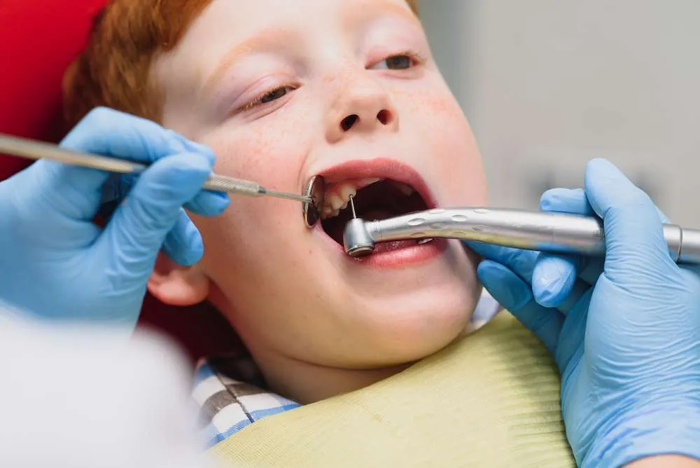Pediatric dentist applying Preventive Resin Restoration for children