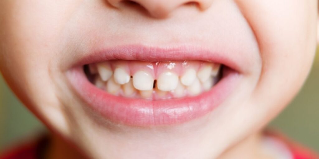 dentist near South Riding, VA